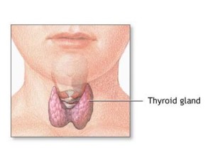 Iodine and Hashimotos Thyroiditis and Graves Disease Thyroide