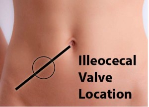 Open Ileocecal Valve ileocecal-valve
