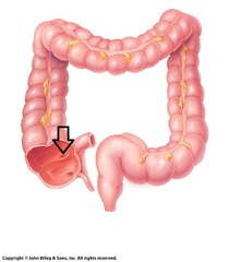 Open Ileocecal Valve t98XHNiBgWo6EgUsw96UlA_m