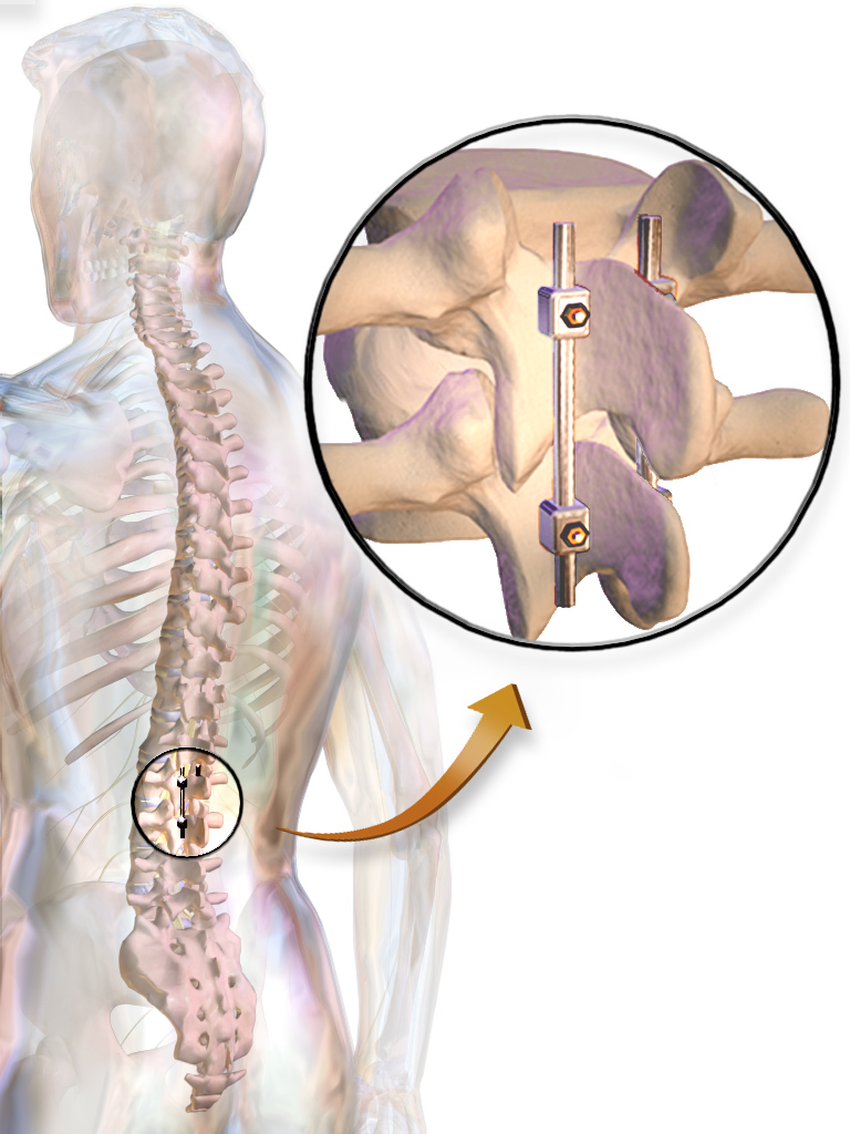 Do You Suffer from Nerve Pain? Nerve Pain