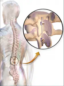 Do You Suffer from Nerve Pain? Nerve Pain