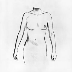 240px Breast reconstruction implant illustration 2