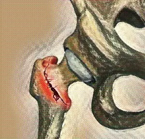 What Does Bone Composition Have to Do with Osteoporosis? imageedit 4 3144717437