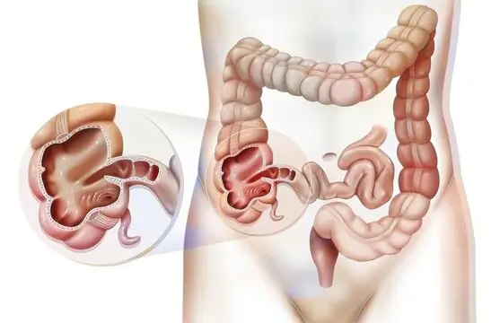 Gut Health & Digestion Digestive difficulties